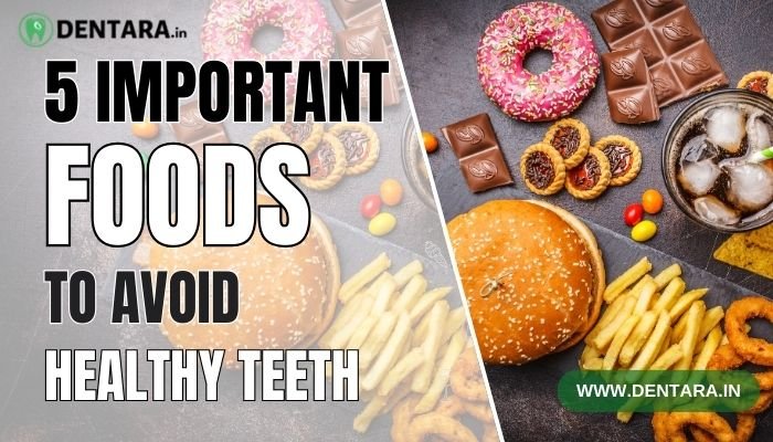 5 Important Foods to Avoid for Healthy Teeth