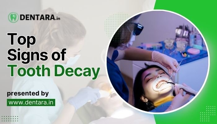 Discover Top Signs of Tooth Decay: Dentara