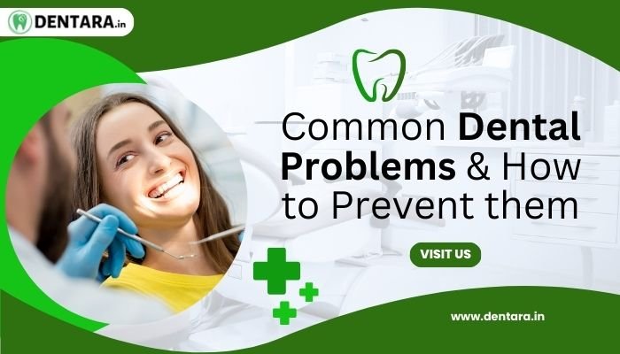 Common dental problems