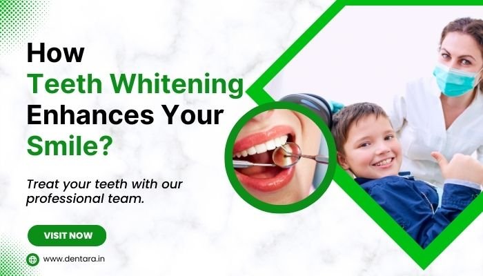 How Teeth Whitening Enhances Your Smile?